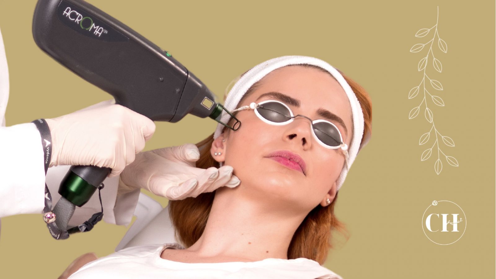 Laser CO2 Fracionado Para Rugas Melasma Acne E Cicatrizes