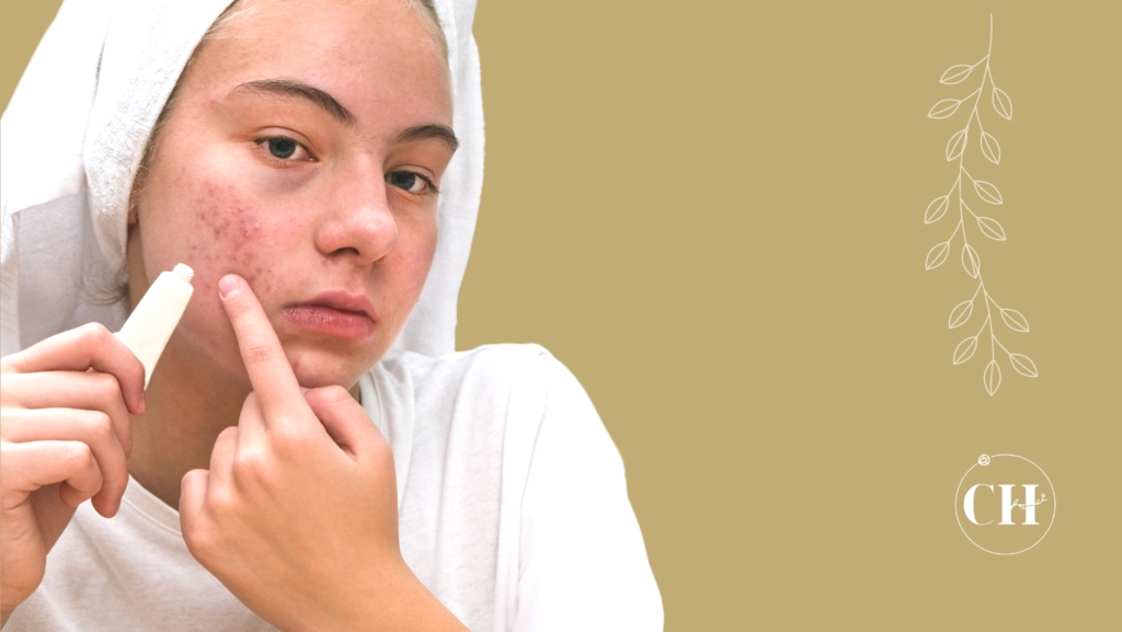 cicatrizes de acne